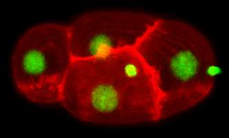 Cell picture of the transparent worm Caenorhabditis elegans in a 4-cell-state.