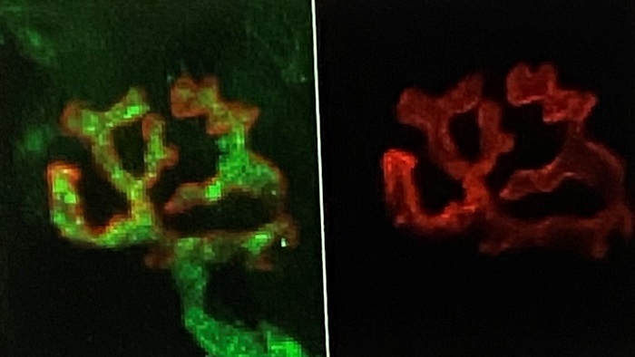 Expression in 10% der untersuchten Neurone wird mit der Postsynapse der untersuchten Neuronen kobiniert dargestellt. Grundlage ist eine konfokal-mikroskopische Aufnahme.